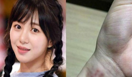 吃瓜韩国娱乐圈,瓜田李下，揭秘明星幕后故事